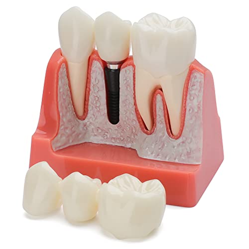 Model zubnih zuba Faruijie Dental Standard - Model zubnih usta modela četkanja zuba za učenje za učenje